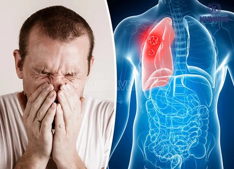 Tác động của bụi đến sức khỏe người lao động Tác động của bụi đến sức khỏe người lao động