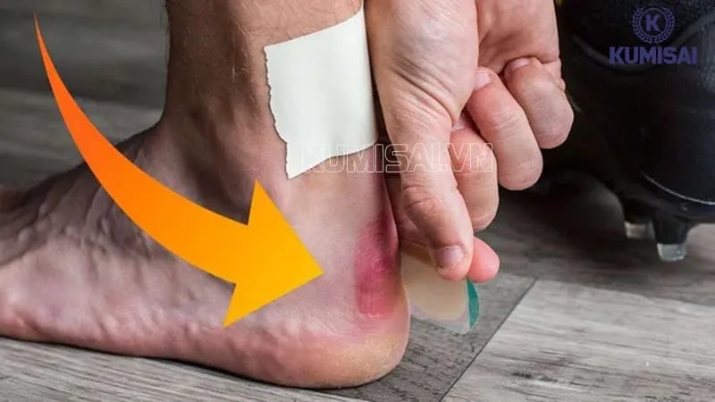 Đi giày da cứng có thể gây đau chân