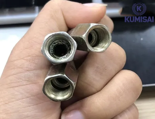 Vú bơm mỡ đầu nhọn - 5